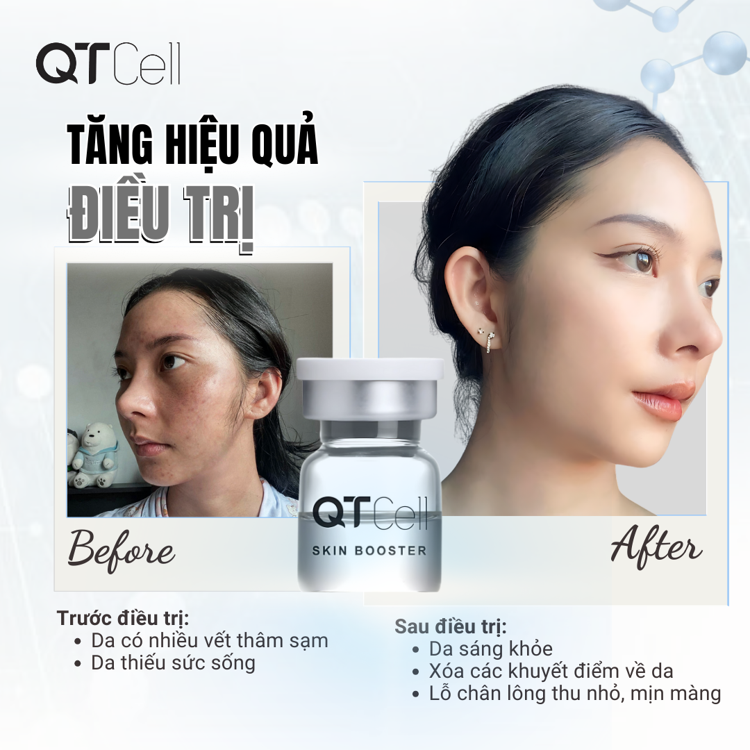Nguyên bào sợi: Kiến tạo cho làn da tươi mới