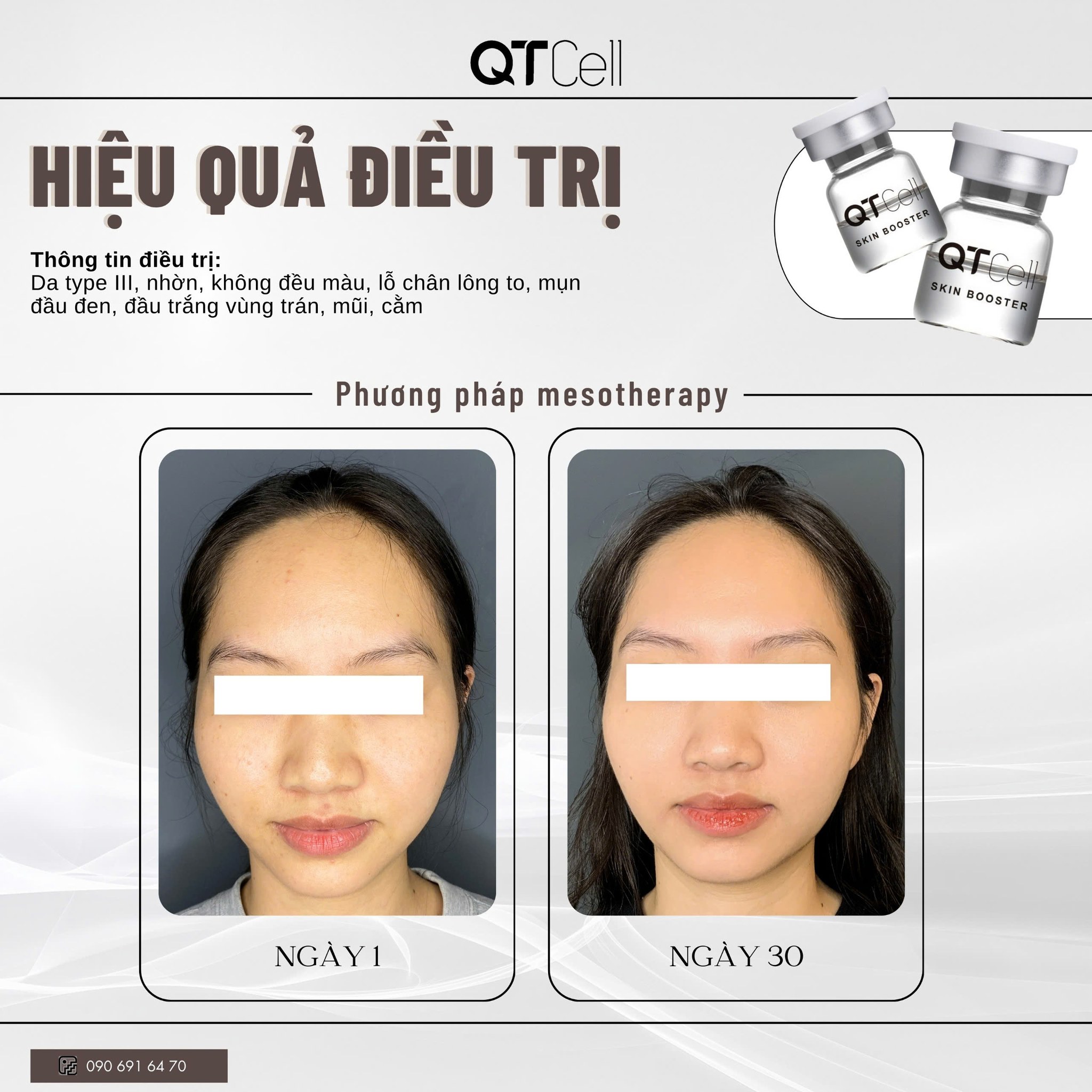 Nguyên bào sợi: Kiến tạo cho làn da tươi mới