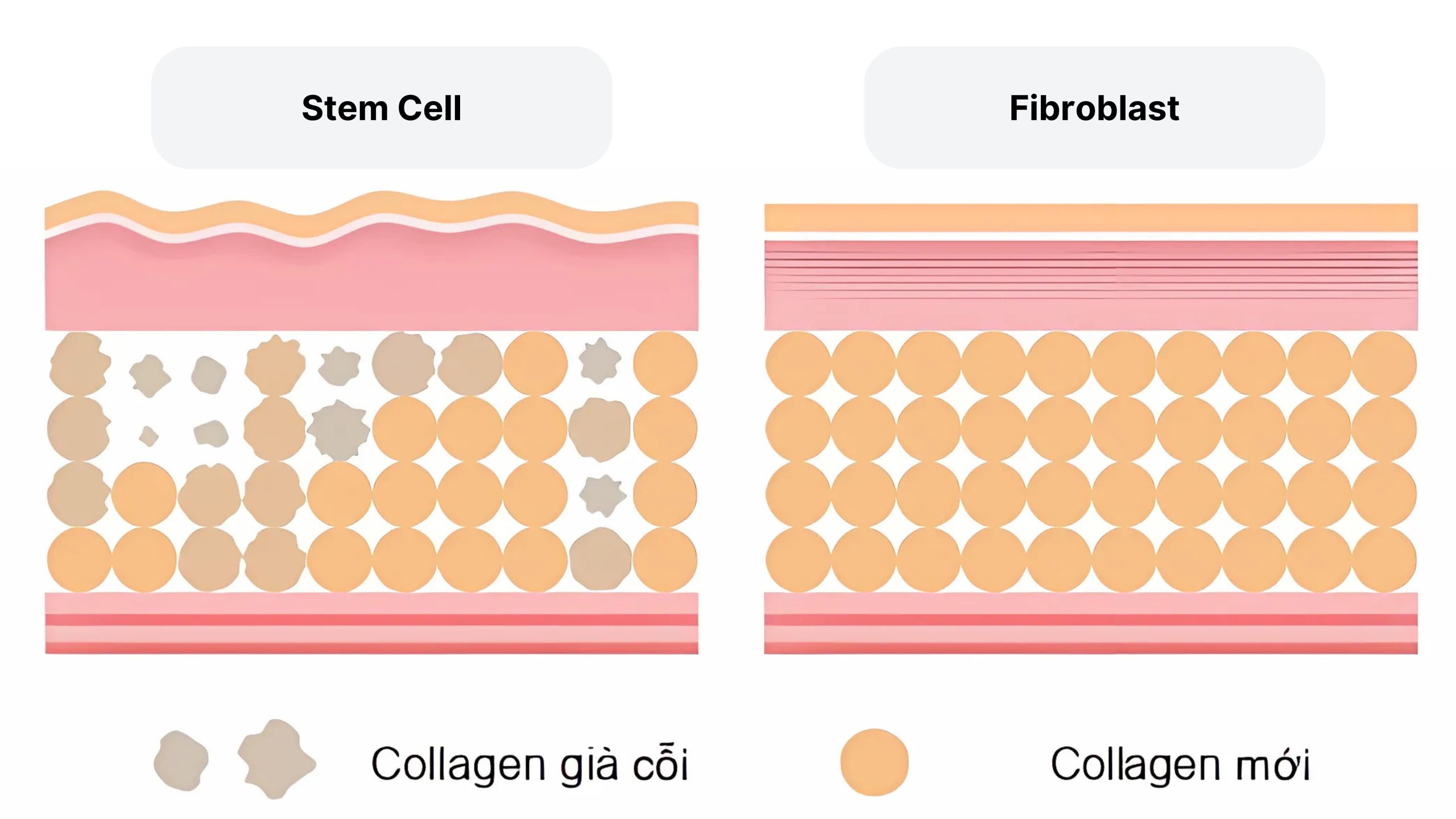 KHÁM PHÁ SỰ KHÁC BIỆT GIỮA TẾ BÀO GỐC VÀ NGUYÊN BÀO SỢI