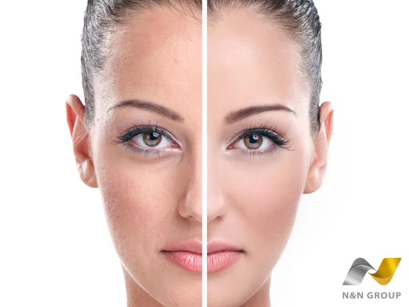 Hiệu quả thực tế từ liệu trình plasma lạnh giảm viêm da