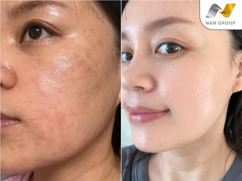 Lợi ích khi sử dụng công nghệ 3D FECS