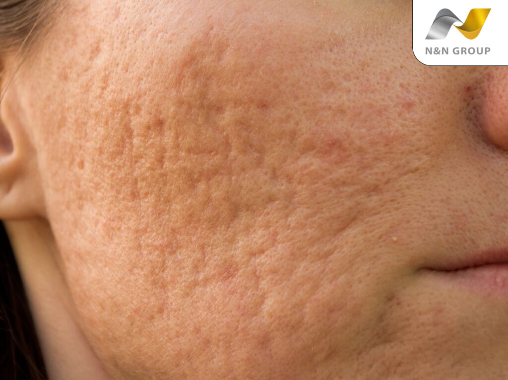 Sự mỏi mệt của làn da cần sự chăm sóc đúng cách